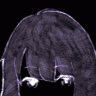 ひぐ